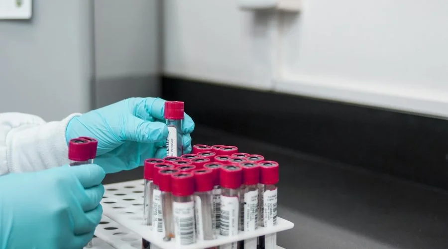 lab, experiment, test