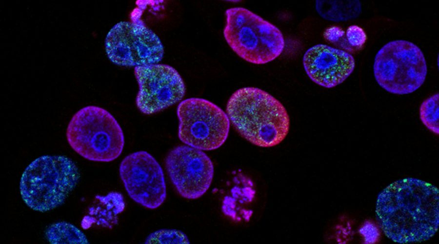 purple cells