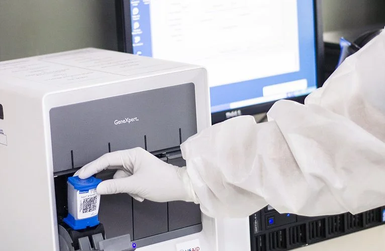 CRISPR-TB Blood Test receives FDA Breakthrough Device Designation