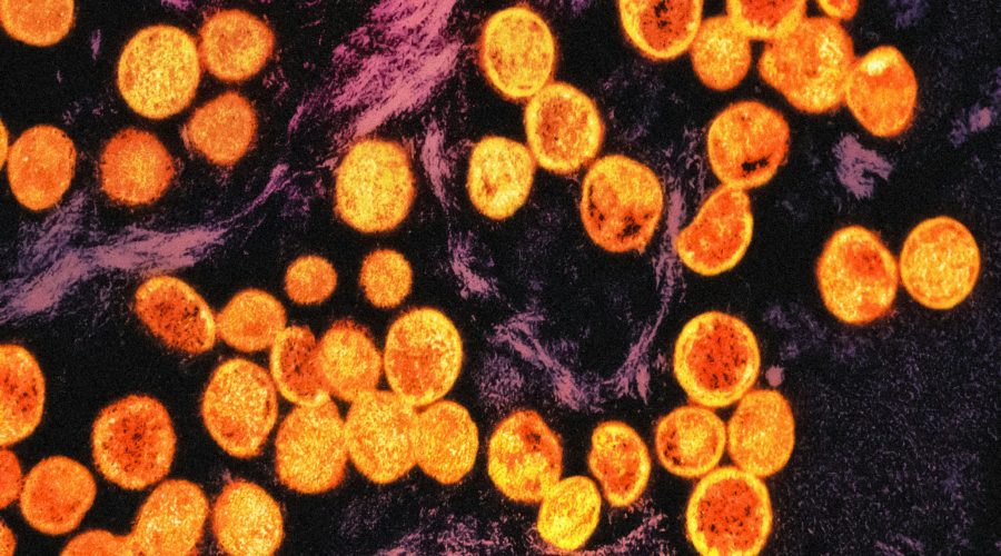 a bunch of orange lights that are on a table